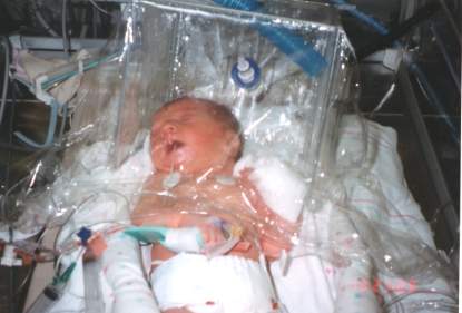 Makenzie in oxygen hood